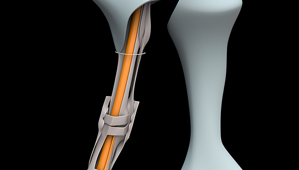 Tout ce que vous devez savoir sur le Creux des hanches